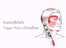 ไมเกรน (โรคปวดศีรษะรุนแรงเรื้อรัง) - ตัวอย่างโรคที่เกิดจากการเสียดุลยภาพ