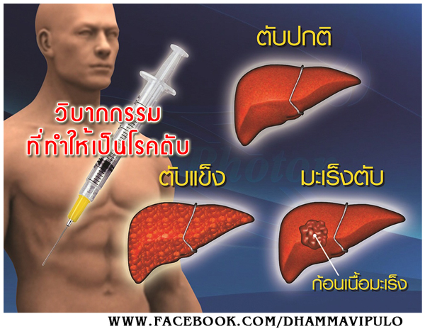วิบากกรรมที่ทำให้เป็นโรคตับ