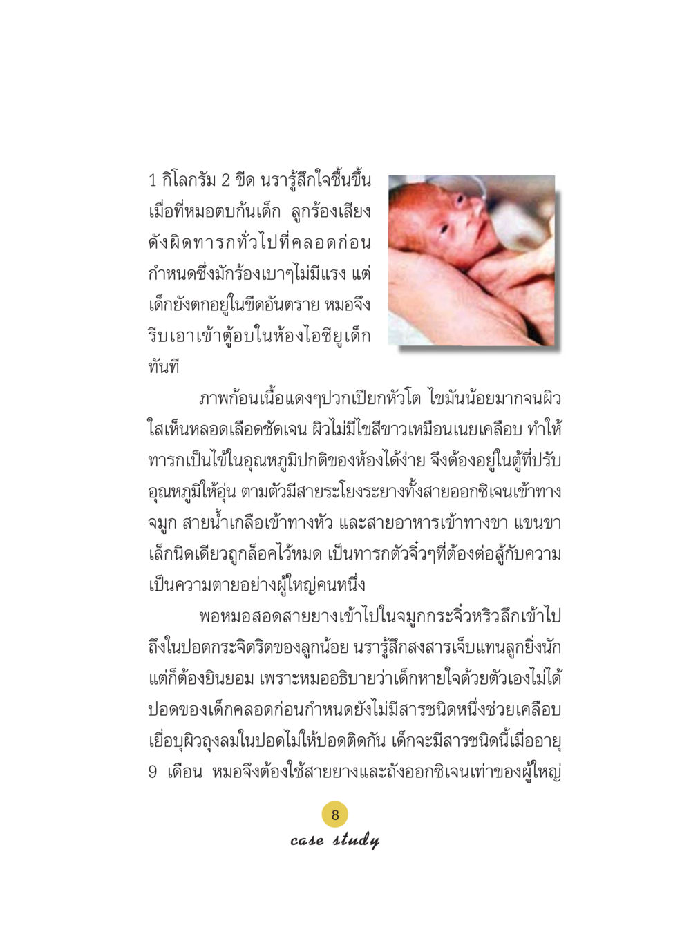 การดูแลทารกคลอดก่อนกำหนด Case Study กฎแห่งกรรม เล่มที่ 5 หน้า 9