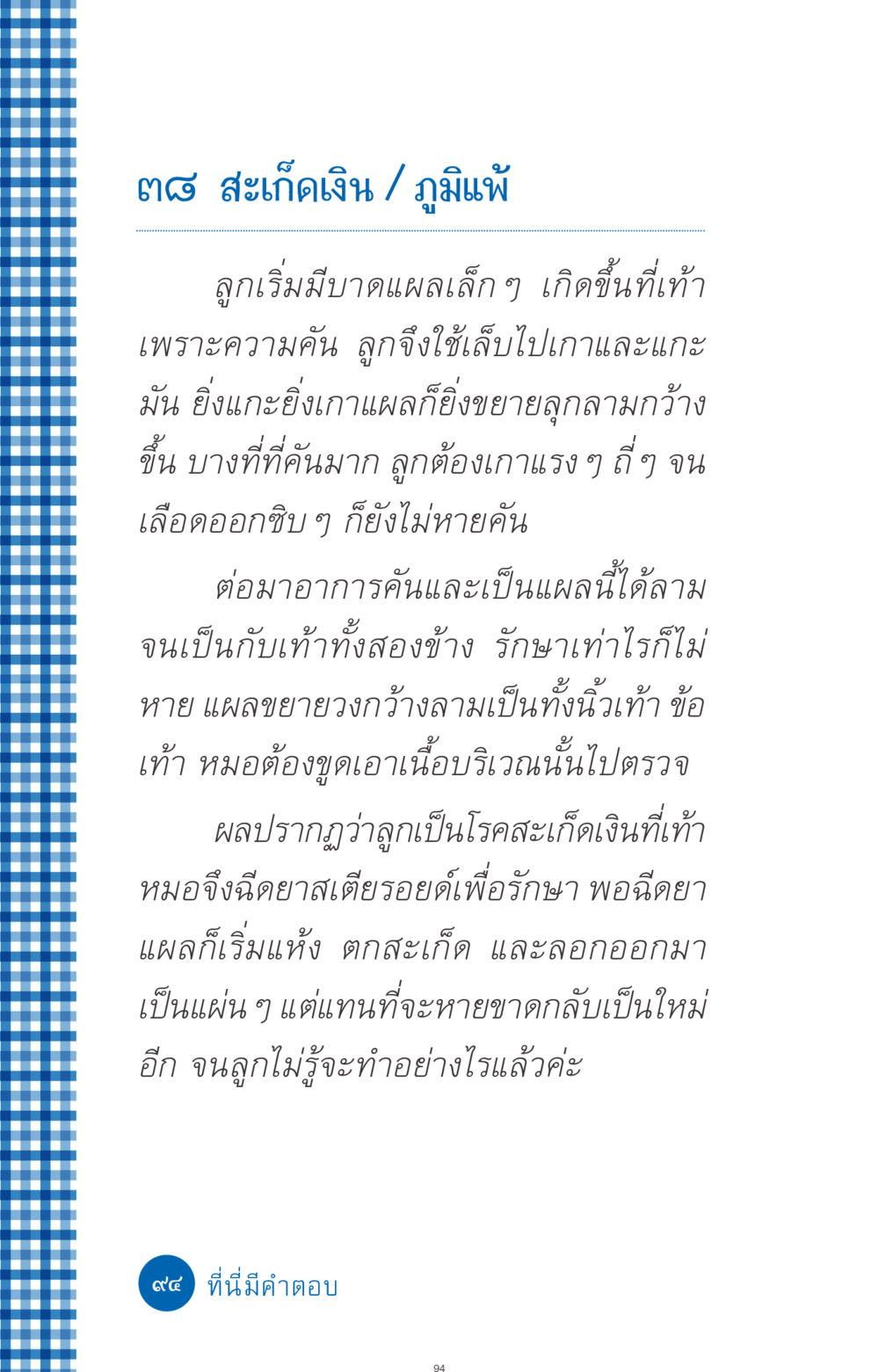 การรักษาโรคสะเก็ดเงินในเด็ก ที่นี่มีคำตอบ ฉบับ mini เล่มที่ 9 เมื่อกรรมให้เกิด หน้า 94
