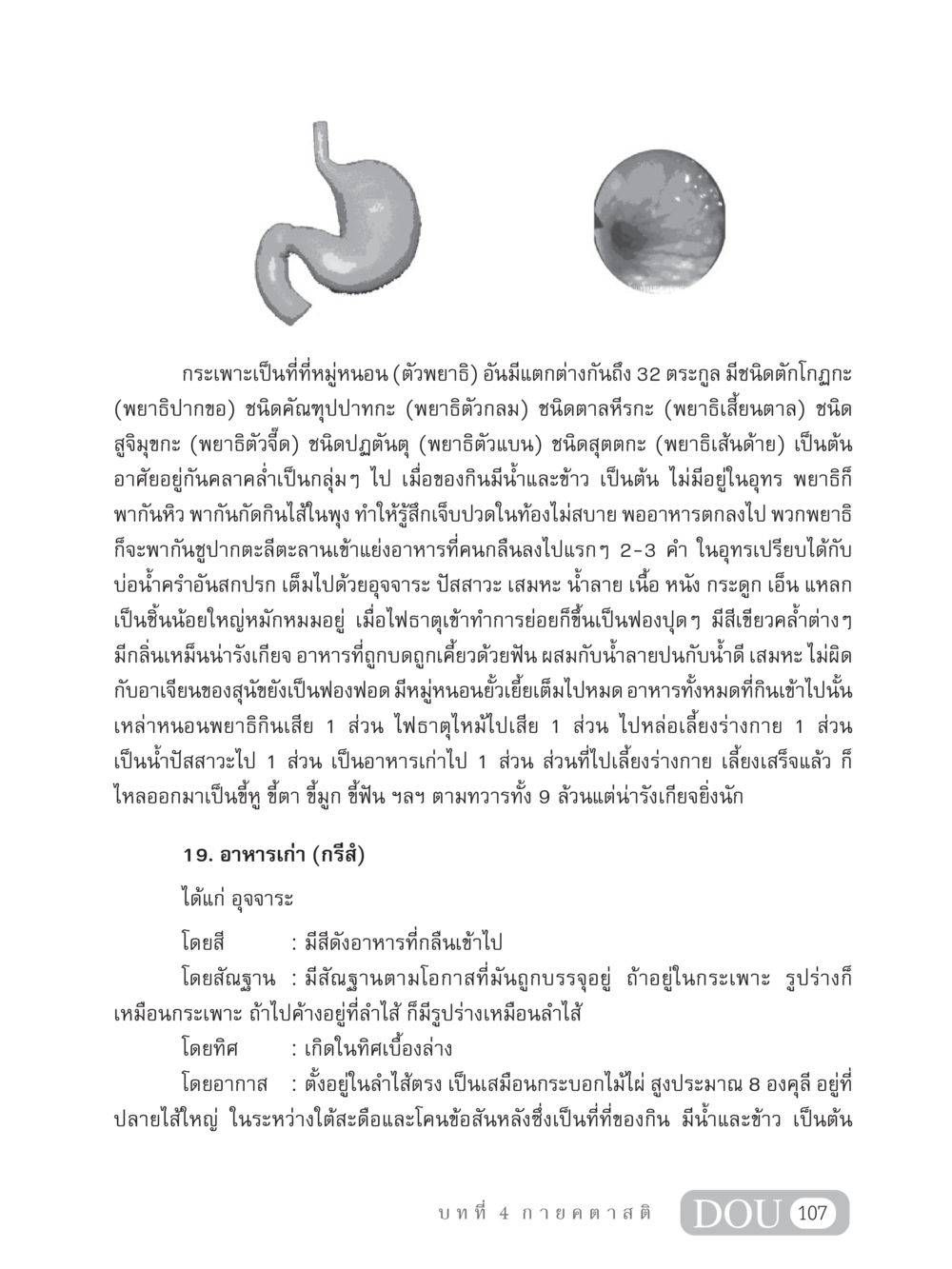 อาการและลักษณะของพยาธิในกระเพาะอาหาร MD 306 สมาธิ 6  หน้า 117