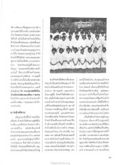 อุปสรรคและความสำเร็จในชีวิต
