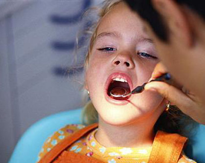 ปัญหาสุขภาพปากและฟันที่สำคุญคือ โรคฟันผุ