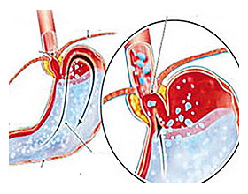 à¸à¸£à¸”ในà¸à¸£à¸°à¹€à¸žà¸²à¸°à¸—ี่หลั่งà¸à¸à¸à¸¡à¸²à¸à¹„ป à¸à¸£à¸”ในà¸à¸£à¸°à¹€à¸žà¸²à¸°à¸—ี่หลั่งà¸à¸à¸à¸¡à¸²à¸à¹„ป